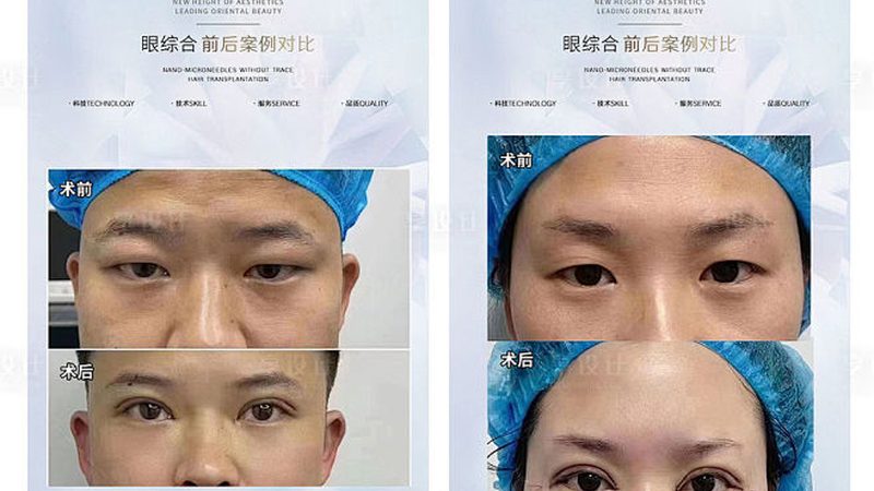 睡觉戴瘦脸口罩对脸型有影响吗