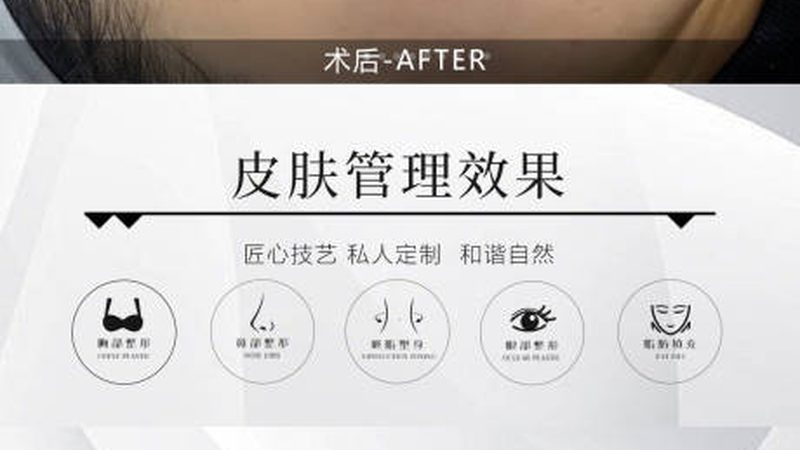 隆鼻失败修复，揭秘术前术后关键步骤