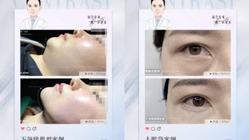 揭秘进口激光祛斑仪器：价格与价值背后的秘密