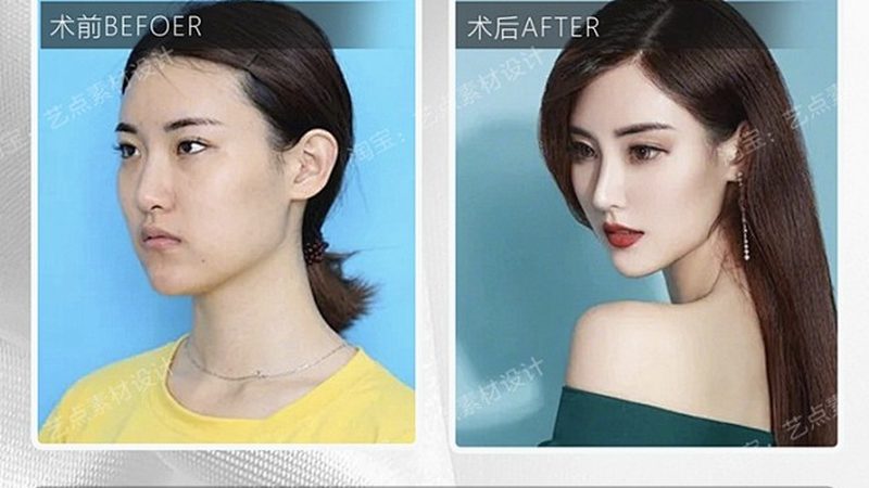 广州皮肤管理中心仪器批发市场：揭秘优质仪器的选型逻辑