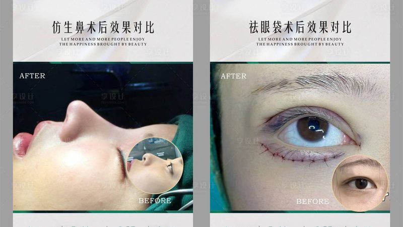 小标题：了解肉毒素除皱原理