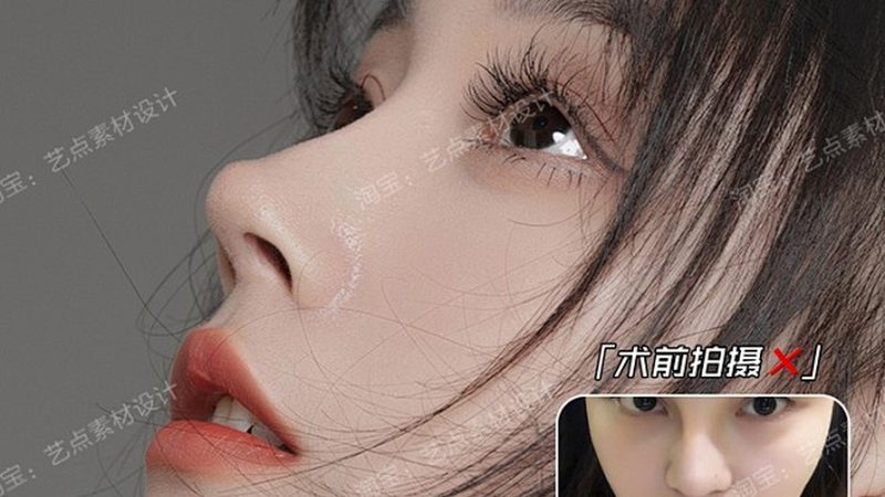 开内眼角双眼皮对比成都哪家好