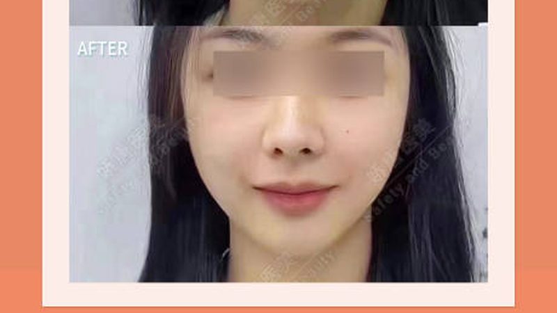皮肤管理中心与美容院投资成本解析：投资背后的考量因素
