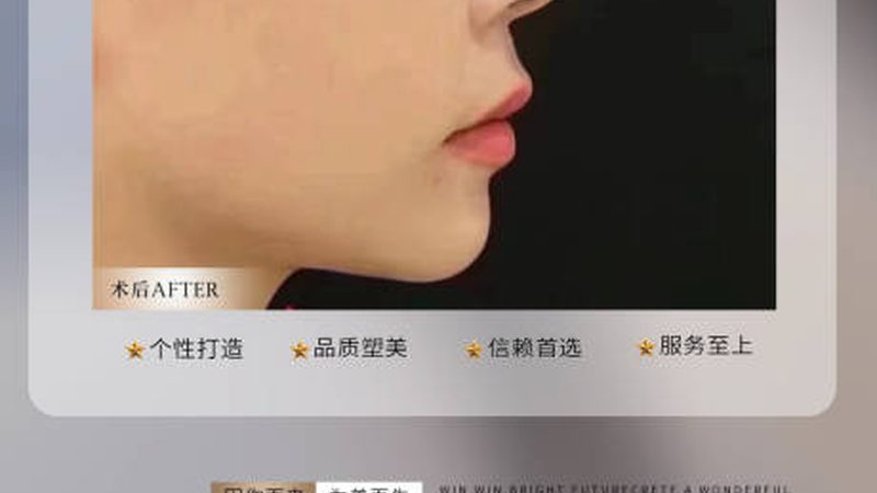 揭秘抗衰口服液：成分解析与选购指南