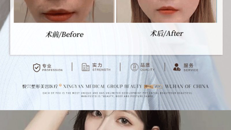 成都超声炮：揭秘其效果背后的技术奥秘