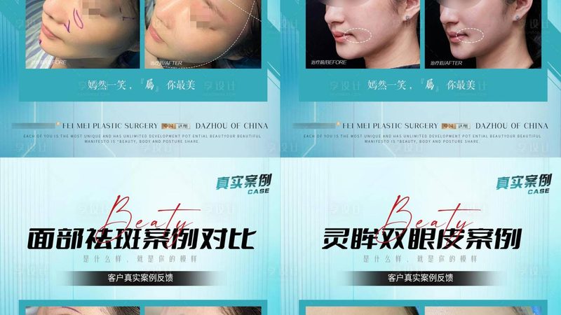 公立医美医院，北京女性的专业选择指南
