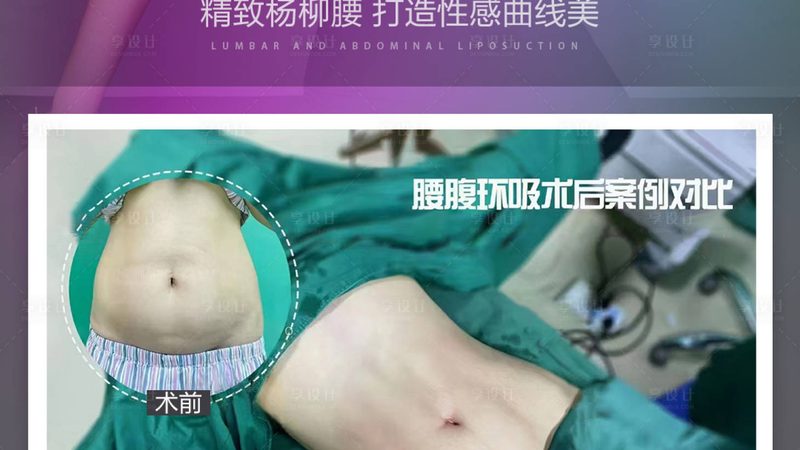 医美咨询师，你的职业成长之路
