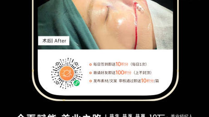 皮肤管理中心线上推广预算多少