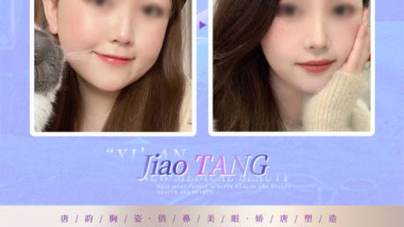 医美咨询师如何运用专业术语与顾客有效沟通