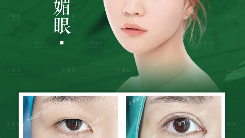 家用激光祛斑仪定制贴牌生产的秘密解析