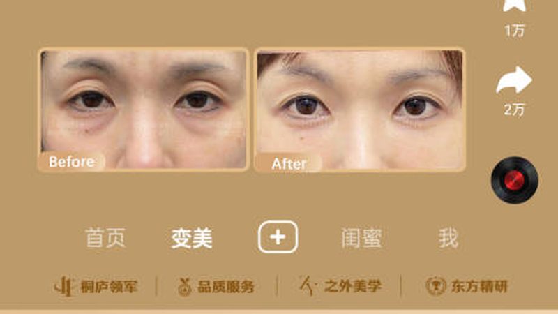 激光脱毛对比图揭秘：小红书上的真实效果分享