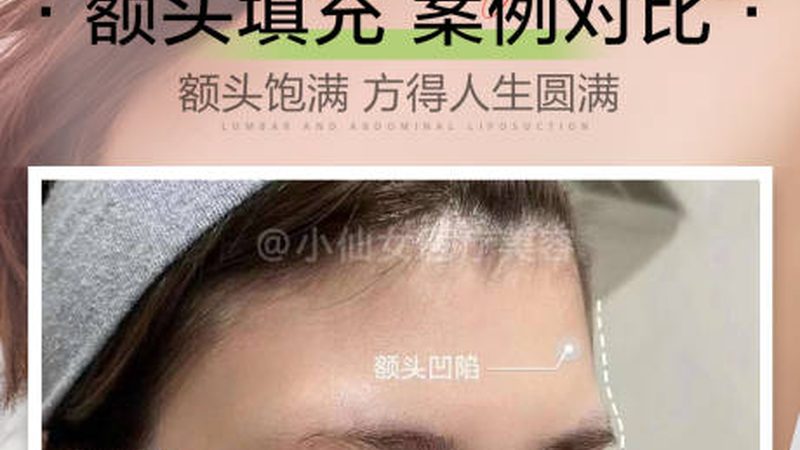 热玛吉2025：揭秘热玛吉技术的进化与价格解析